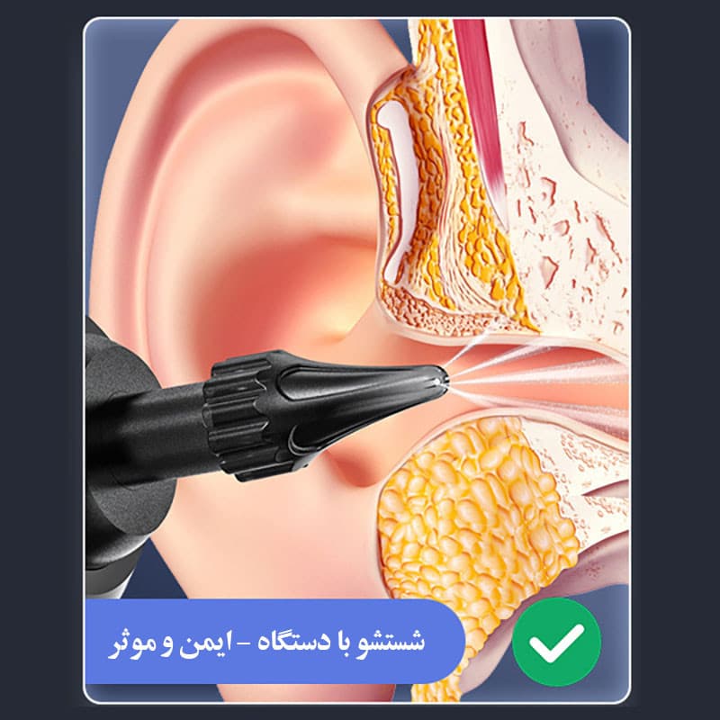 گوش پاککن برقی مدل Remover - Image 8