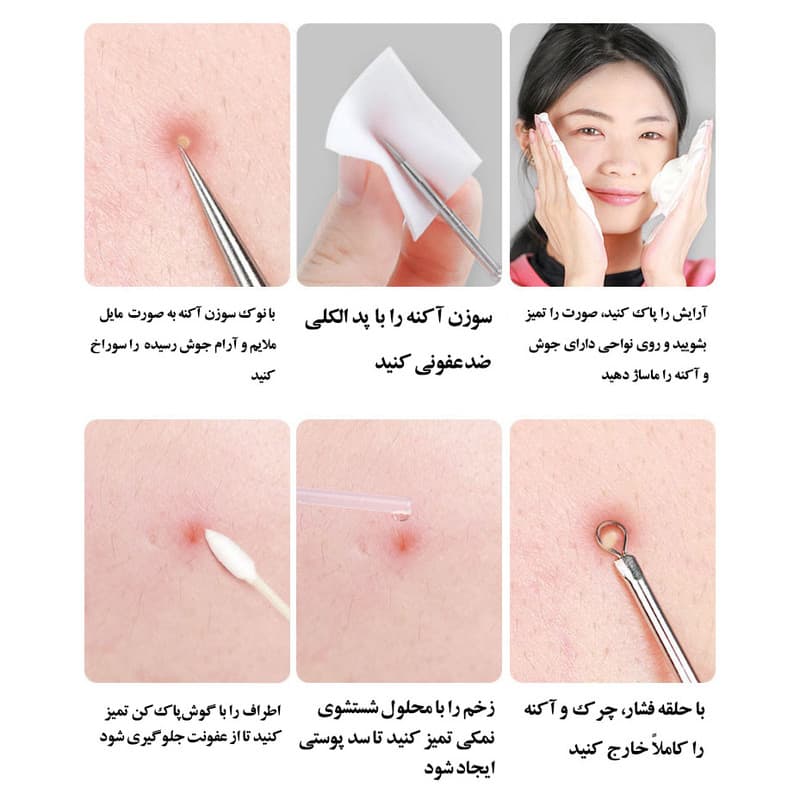 مجموعه ابزار پاکسازی پوست جیکومو مدل Anti-Acne بسته 8 عددی - Image 5
