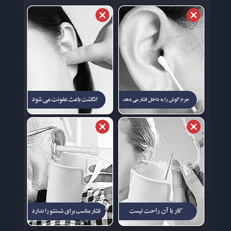 گوش پاککن برقی مدل Remover - Image 9