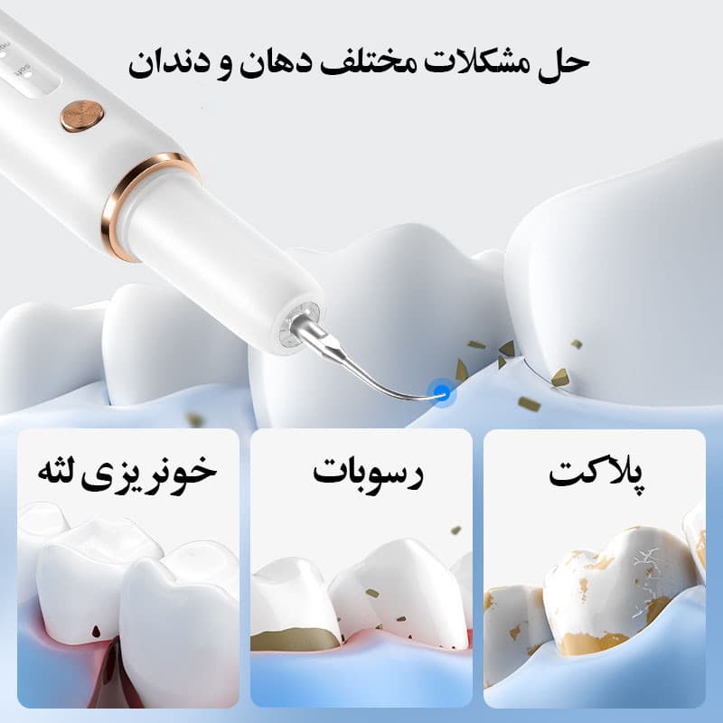 دستگاه جرم گیر دندان شارژی کروی مون مدل sonicare - Image 19