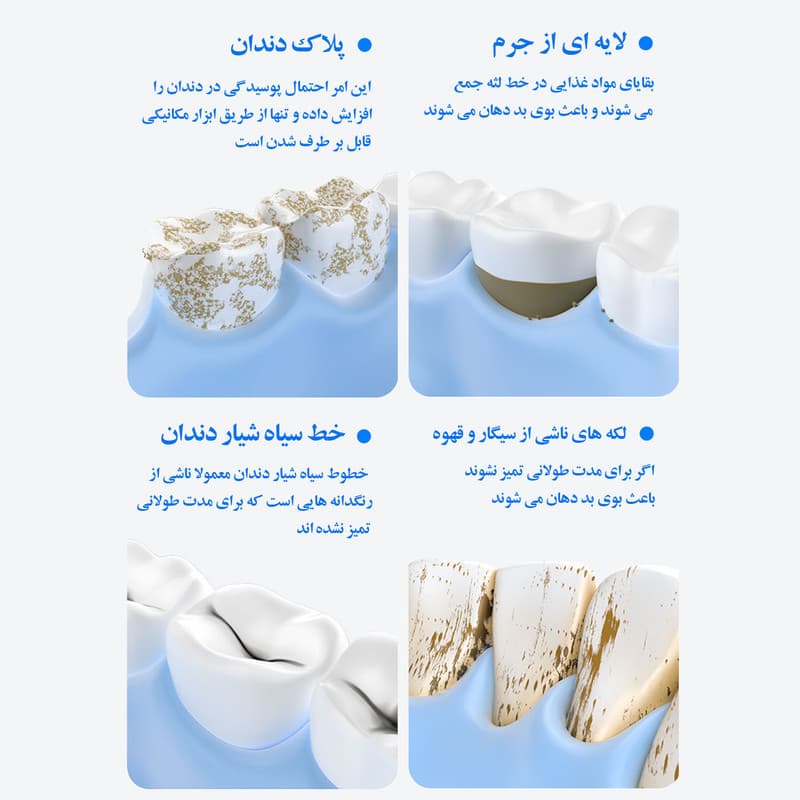 دستگاه جرم گیر دندان شارژی کروی مون مدل sonicare - Image 5