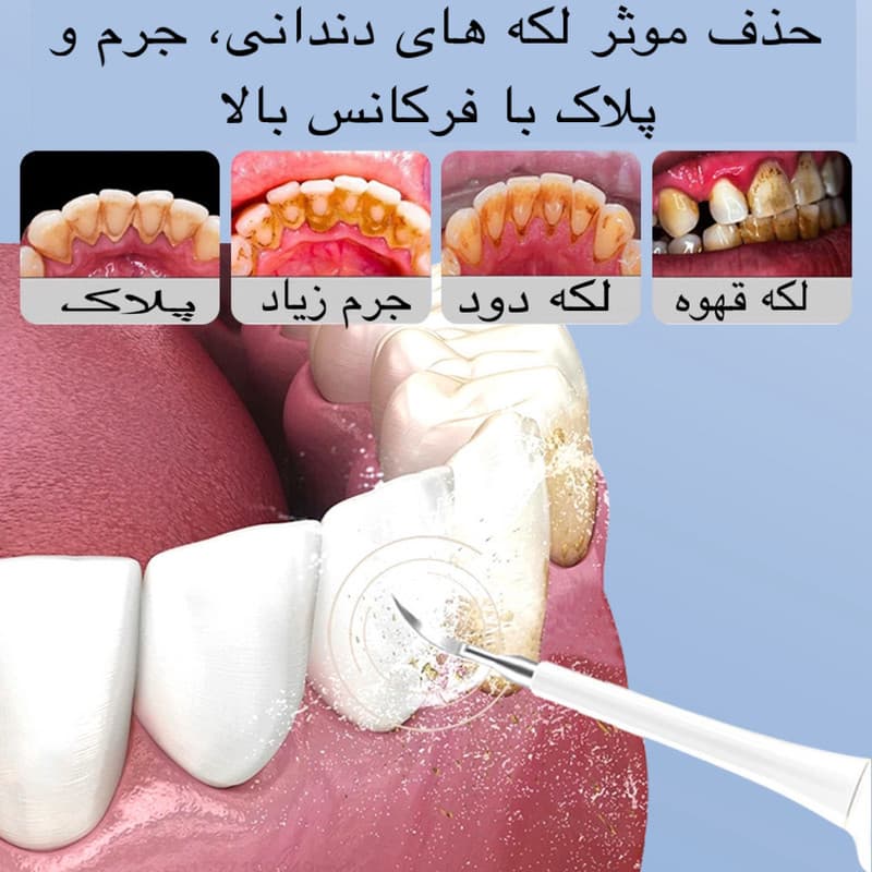 جرم گیر خانگی و مسواک برقی مدل LC-H228 - Image 6